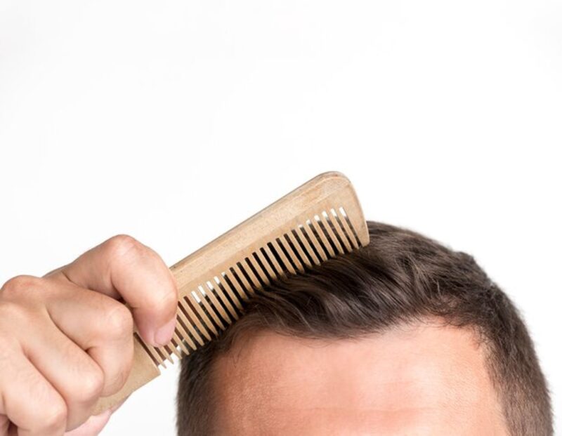 پیشگیری از ریزش مو مرتبط با ریزش مو و تقویت مو